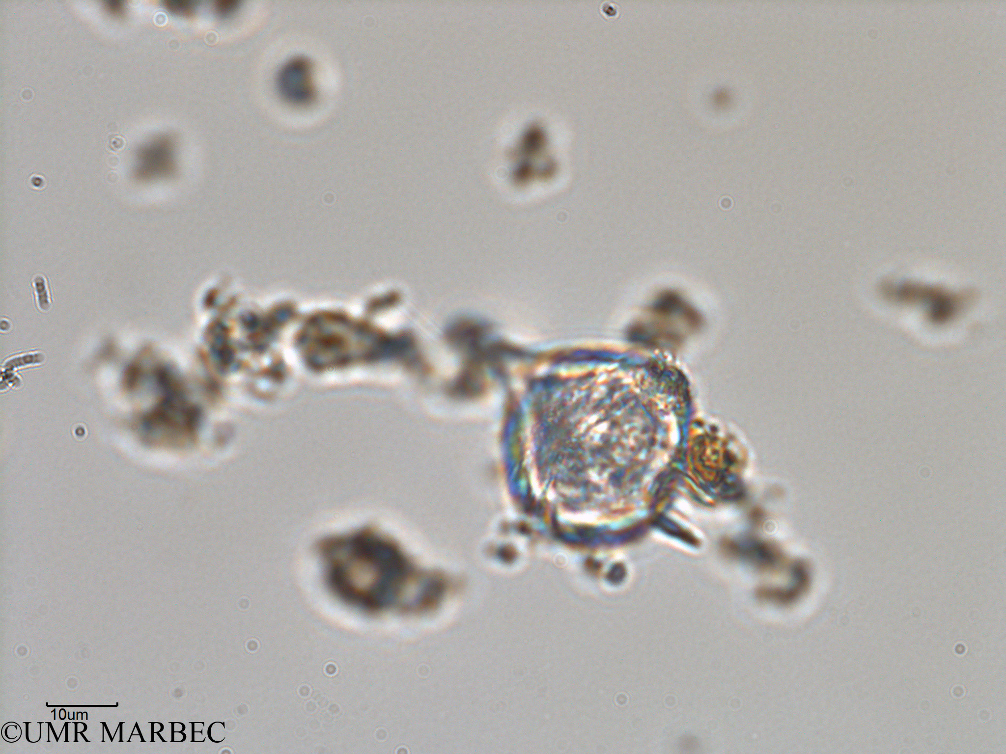 phyto/Bizerte/bizerte_lagoon/RISCO February 2015/Protoperidinium sp31 (ancien Lagune_T1-C-Protoperidinium sp31 -2).tif(copy).jpg
